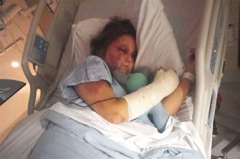 kirra hart today|Sunshine Coast: 13yo girl allegedly tortured, three charged